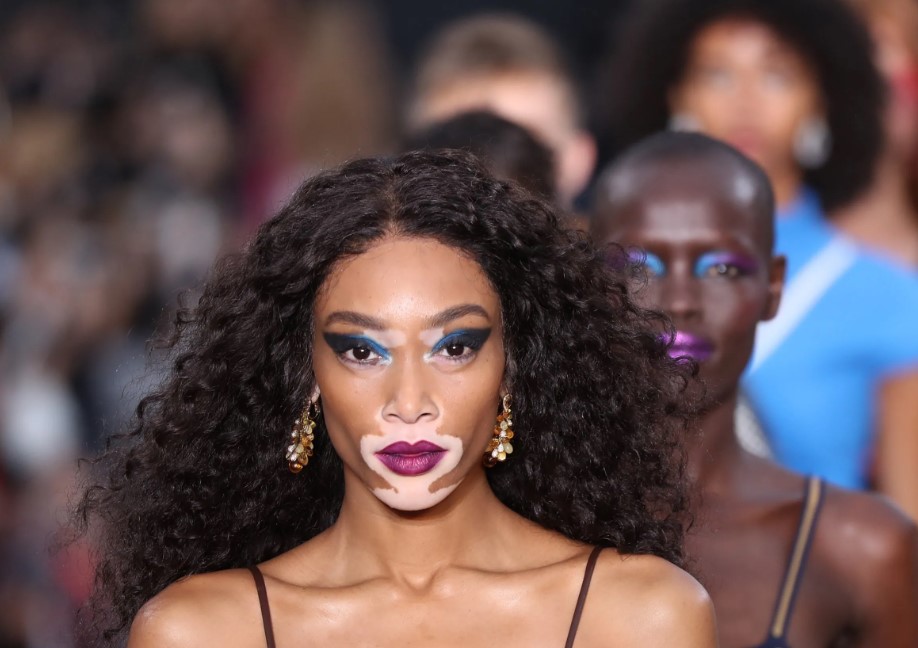 How to Contact Winnie Harlow: Phone number, Texting, Email Id, Fanmail Address and Contact Details